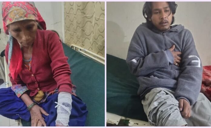 जोशीमठ में भालू का खूनी हमला, एक परिवार के चार सदस्य घायल, वन विभाग ने दी 15 हजार राहत